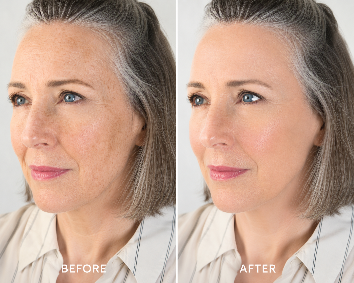 4. Reverses years of sun damage